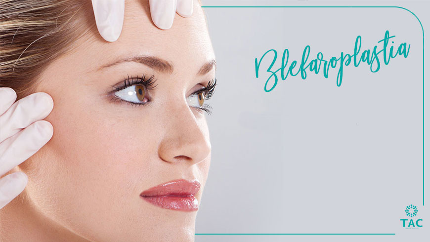 Olheiras e pálpebras cansadas? Já existe solução eficaz: Blefaroplastia