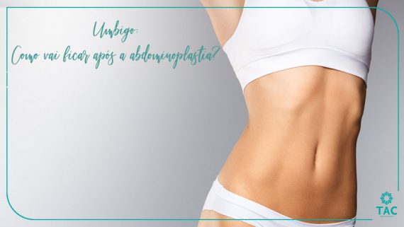 Umbigo: Como vai ficar após a abdominoplastia?