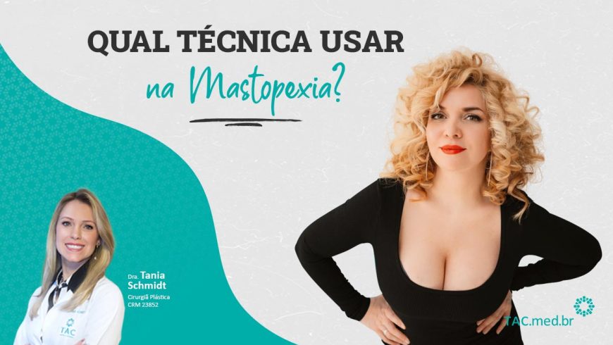 Qual técnica usar na Mastopexia?