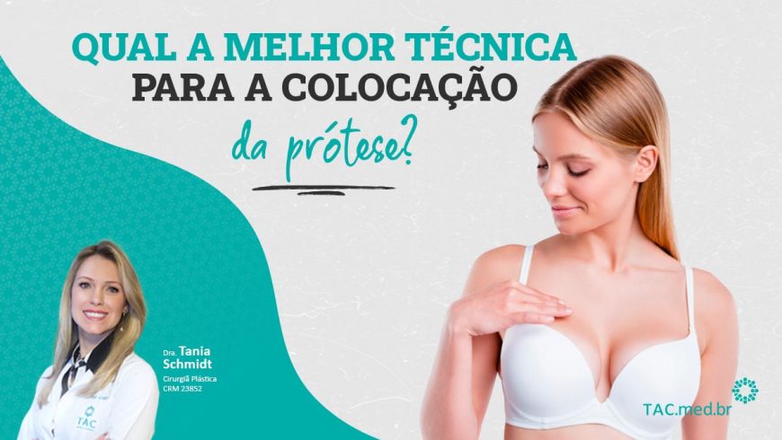 Qual a melhor técnica para a colocação da prótese?